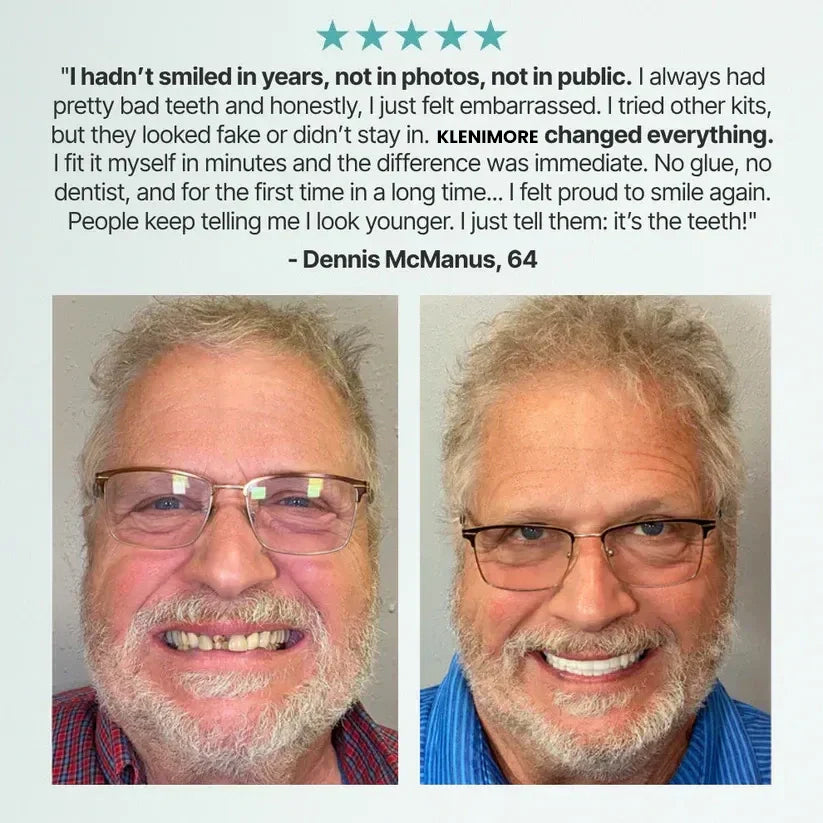 🦷 Realistic Upper & Lower Dentures – Natural Smile in Seconds ✨